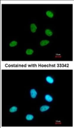 P15RS Antibody, Novus Biologicals 0.1mL; Unlabeled:Antibodies, Polyclonal