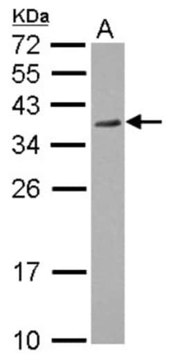 P15RS Antibody, Novus Biologicals 0.1mL; Unlabeled:Antibodies, Polyclonal