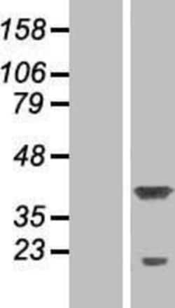 Novus Biologicals&trade;&nbsp;P15RS Overexpression Lysate