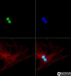 p19ARF/CDKN2A Antibody - BSA Free, Novus Biologicals:Antibodies:Primary
