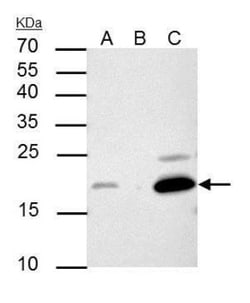 p21/CIP1/CDKN1A Antibody (1032), Novus Biologicals 0.1mL; Unlabeled:Antibodies,