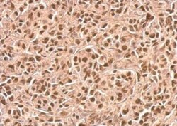 p21/CIP1/CDKN1A Antibody, Novus Biologicals 0.1 mL | Buy Online | Novus Biologicals | Fisher Scientific