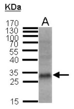 p27/Kip1 Antibody, Novus Biologicals 0.1mL; Unlabeled:Antibodies, Polyclonal