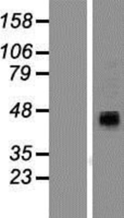Novus Biologicals&trade;&nbsp;P2X4 Overexpression Lysate