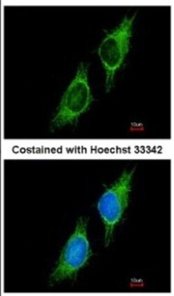 P2X2/P2RX2 Antibody, Novus Biologicals 0.1mL; Unlabeled:Antibodies, Polyclonal