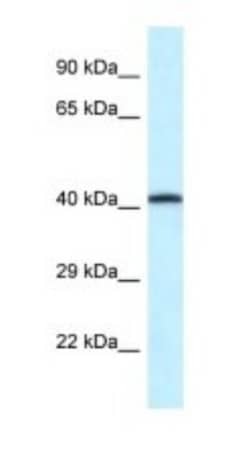 P2X2/P2RX2 Antibody, Novus Biologicals 100&mu;L; Unlabeled:Antibodies,