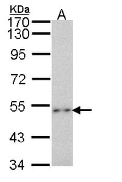 P2X2/P2RX2 Antibody, Novus Biologicals 0.1mL; Unlabeled:Antibodies, Polyclonal