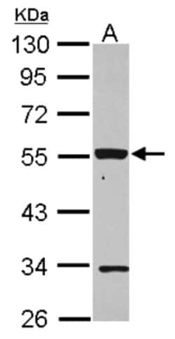 P2X2/P2RX2 Antibody, Novus Biologicals 0.1 mL | Buy Online | Novus Biologicals | Fisher Scientific
