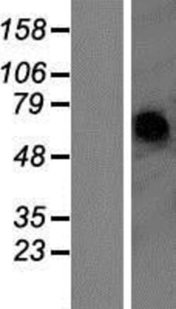 Novus Biologicals&trade;&nbsp;P2X2/P2RX2 Overexpression Lysate