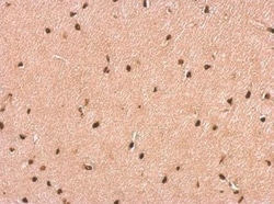 P2X2/P2RX2 Antibody, Novus Biologicals 0.1mL; Unlabeled:Antibodies, Polyclonal