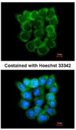 P2X5/P2RX5 Antibody, Novus Biologicals 0.1mL; Unlabeled:Antibodies, Polyclonal