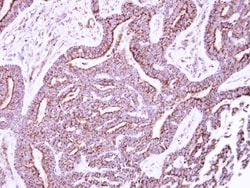 P2X5/P2RX5 Antibody, Novus Biologicals 0.1mL; Unlabeled:Antibodies, Polyclonal
