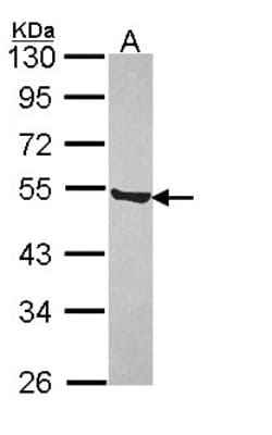 P2X5/P2RX5 Antibody, Novus Biologicals 0.1mL; Unlabeled:Antibodies, Polyclonal