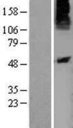 Novus Biologicals&trade;&nbsp;P2Y10/P2RY10 Overexpression Lysate
