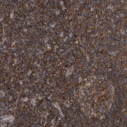 P2Y10/P2RY10 Antibody, Novus Biologicals 0.1mL; Unlabeled:Antibodies, Polyclonal