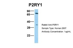 P2Y1/P2RY1 Antibody, Novus Biologicals 0.05mg; Unlabeled:Antibodies, Polyclonal