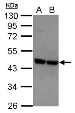P2Y2 Antibody, Novus Biologicals 0.1mL; Unlabeled:Antibodies, Polyclonal