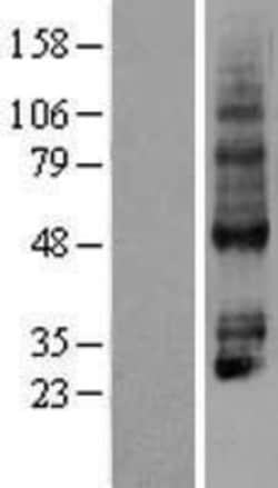 Novus Biologicals™ P2Y4/P2RY4 Overexpression Lysate
