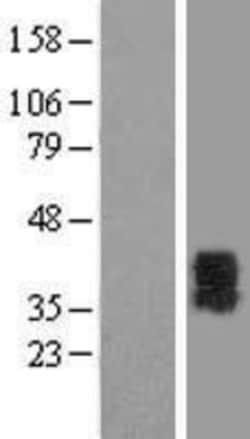 Novus Biologicals™ P2Y6/P2RY6 Overexpression Lysate