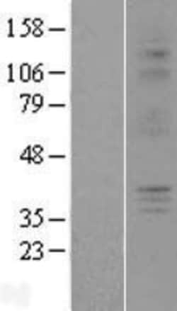Novus Biologicals&trade;&nbsp;P2Y6/P2RY6 Overexpression Lysate