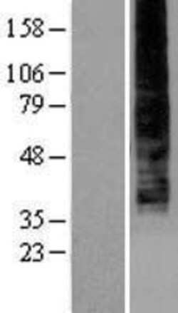 Novus Biologicals&trade;&nbsp;LPAR4/LPA4 Overexpression Lysate