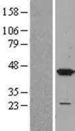 Novus Biologicals&trade;&nbsp;p38 alpha Overexpression Lysate