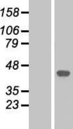 Novus Biologicals&trade;&nbsp;p38 alpha Overexpression Lysate