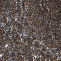 p38 delta/SAPK4 Antibody, Novus Biologicals:Antibodies:Primary Antibodies
