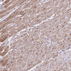 p38 gamma/SAPK3 Antibody, Novus Biologicals 25 &mu;L, Unlabeled:Antibodies,