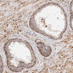 p40 Antibody, Novus Biologicals 0.1mL; Unlabeled:Antikörper