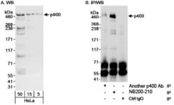 p400 Antibody, Novus Biologicals 0.1mL; Unlabeled:Antibodies, Polyclonal