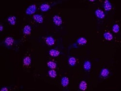 p400 Antibody, Novus Biologicals 0.1mL; Unlabeled:Antibodies, Polyclonal