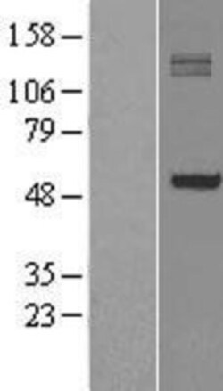 Novus Biologicals&trade;&nbsp;P4HA1 Overexpression Lysate