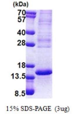 Novus Biologicals&trade;&nbsp;Recombinant Human p53 AIP1 His Protein
