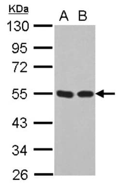 p53 Antibody (Pab1801), Novus Biologicals 0.1mg; Unlabeled:Antibodies,