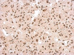 p53 Antibody, Novus Biologicals 0.1mL; Unlabeled:Antibodies, Polyclonal