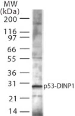 p53 DINP1 Antibody, Novus Biologicals:Antibodies:Primary Antibodies