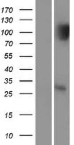 Novus Biologicals&trade;&nbsp;p53 DINP1 Overexpression Lysate