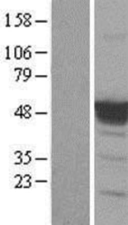 Novus Biologicals™ p53 Overexpression Lysate