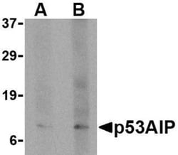 p53 AIP1 Antibody, Novus Biologicals 0.025 mg, Unconjugated:Antibodies,