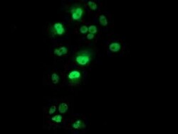 p53 Antibody (OTI5E2), Novus Biologicals 0.1mL; Unlabeled:Antibodies, Monoclonal