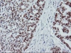 p53 Antibody (OTI5E2), Novus Biologicals 0.1mL; Unlabeled:Antibodies, Monoclonal