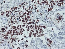 p53 Antibody (OTI5E2), Novus Biologicals 0.1mL; Unlabeled:Antibodies, Monoclonal