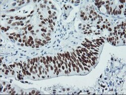 p53 Antibody (OTI5E2), Novus Biologicals 0.1mL; Unlabeled:Antibodies, Monoclonal