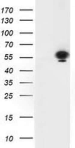 p53 Antibody (OTI5E2), Novus Biologicals 0.1mL; Unlabeled:Antibodies, Monoclonal