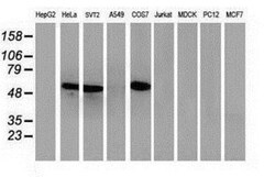 p53 Antibody (OTI5E2), Novus Biologicals 0.1mL; Unlabeled:Antibodies, Monoclonal