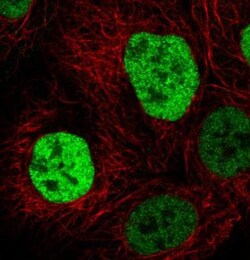 p53 Antibody (CL2199), Novus Biologicals 0.1mL; Unlabeled:Antibodies, Monoclonal