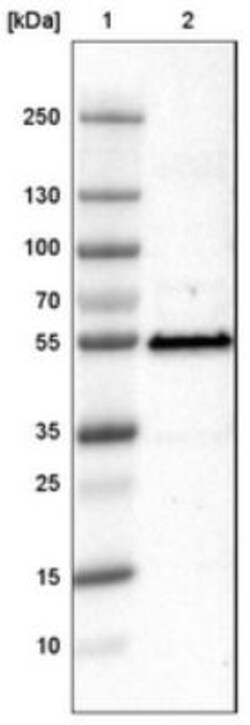 p53 Antibody (CL2199), Novus Biologicals 0.1mL; Unlabeled:Antibodies, Monoclonal