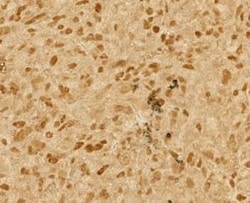 p53 Antibody (Pab1801), Novus Biologicals 0.1mg; Unlabeled:Antibodies,