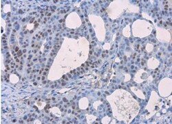 p53 Antibody (Pab1801), Novus Biologicals 0.1mg; Unlabeled:Antibodies,